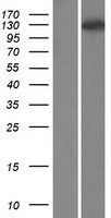 WDR6 Human Over-expression Lysate