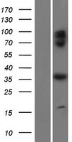 C17orf59 (BORCS6) Human Over-expression Lysate