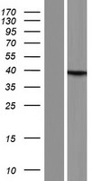 Ataxin 3 (ATXN3) Human Over-expression Lysate