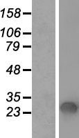 SFTPA1 Human Over-expression Lysate