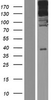 NHSL1 Human Over-expression Lysate