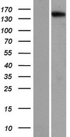 NTE (PNPLA6) Human Over-expression Lysate