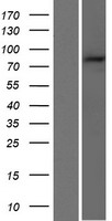 PARP9 Human Over-expression Lysate