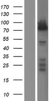 EPB41 Human Over-expression Lysate