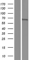 TKTL1 Human Over-expression Lysate