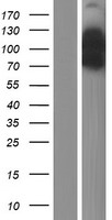 EPS15 Human Over-expression Lysate