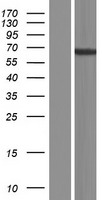 TENR (ADAD1) Human Over-expression Lysate