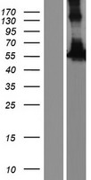 RASGRP 4 (RASGRP4) Human Over-expression Lysate