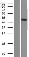 TRIM64B Human Over-expression Lysate