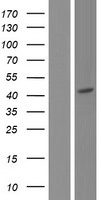 P2X6 (P2RX6) Human Over-expression Lysate