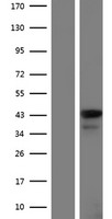 Leukotriene B4 Receptor 2 (LTB4R2) Human Over-expression Lysate