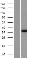GEMC1 (GMNC) Human Over-expression Lysate