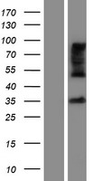 ZDHHC15 Human Over-expression Lysate