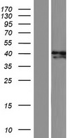 ADAL Human Over-expression Lysate