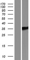 Endothelin A Receptor (EDNRA) Human Over-expression Lysate
