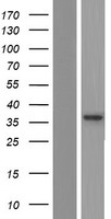 GLRB Human Over-expression Lysate