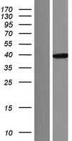 Aspartate beta hydroxylase (ASPH) Human Over-expression Lysate
