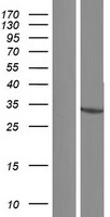 HSDL1 Human Over-expression Lysate