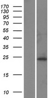 PDHX Human Over-expression Lysate