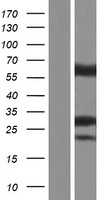 HMGCL Human Over-expression Lysate