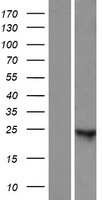 ANKRD66 Human Over-expression Lysate