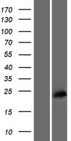 ACTR3C Human Over-expression Lysate