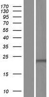 TLCD1 Human Over-expression Lysate