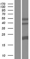 SFTPA1 Human Over-expression Lysate