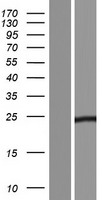 TICAM2 (TMED7-TICAM2) Human Over-expression Lysate