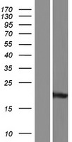 RAB2B Human Over-expression Lysate