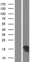CC2D2A Human Over-expression Lysate