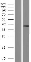 Trypsin (PRSS3) Human Over-expression Lysate