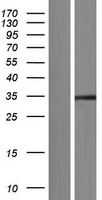 SAE1 Human Over-expression Lysate