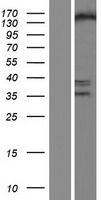 SETDB1 Human Over-expression Lysate