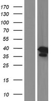 DSN1 Human Over-expression Lysate
