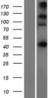 KIAA1712 (CEP44) Human Over-expression Lysate