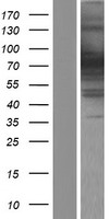 EXOC7 Human Over-expression Lysate