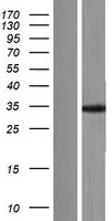 TPM4 Human Over-expression Lysate