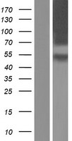 CRF1 (CRHR1) Human Over-expression Lysate