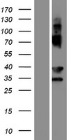 EVPLL Human Over-expression Lysate