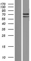 PATL2 Human Over-expression Lysate