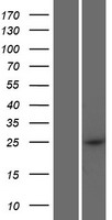 CCDC169 Human Over-expression Lysate
