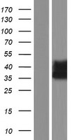 RAB34 Human Over-expression Lysate