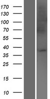 UBAC2 Human Over-expression Lysate