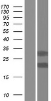 TMX2 Human Over-expression Lysate