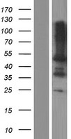 Leupaxin (LPXN) Human Over-expression Lysate