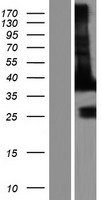 EB2 (MAPRE2) Human Over-expression Lysate