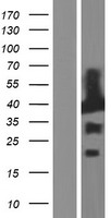 EB2 (MAPRE2) Human Over-expression Lysate