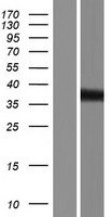 Tropomodulin 2 (TMOD2) Human Over-expression Lysate
