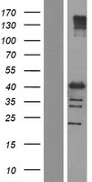NFYC Human Over-expression Lysate